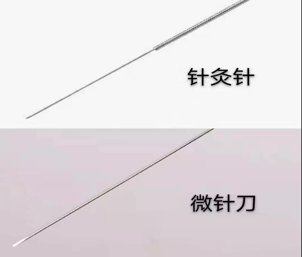 什么是微针刀?